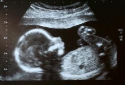 scan-of-baby-in-the-womb